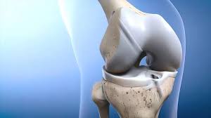 ACL ligament treatment